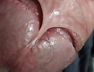 virgin penis very close prevalent seen and show skin lock of penis freak