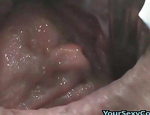 Extreme anal and cookie prolapse after bizarre dp
